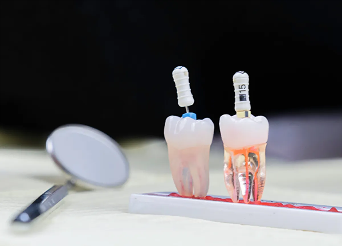  感染状態を診査 進行度に合わせた治療を実践する