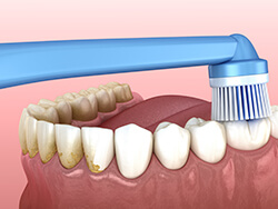 PMTCプロフェショナルクリーニング