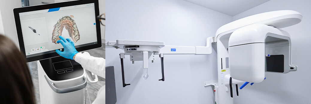 矯正歯科治療の精密性